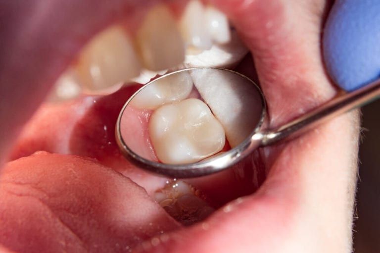 dental examining teeth with instrument