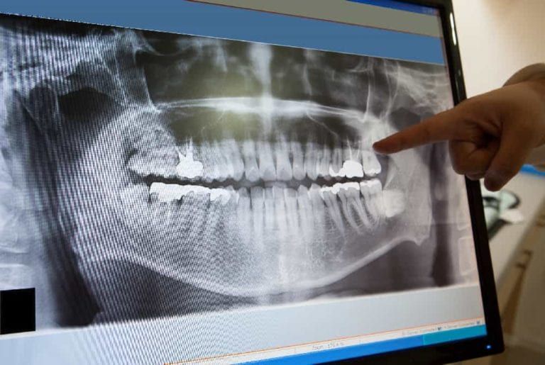 dentist pointing at a digital x ray