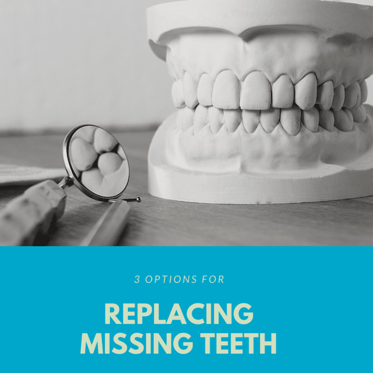 3 Options for Replacing Missing Teeth (1)