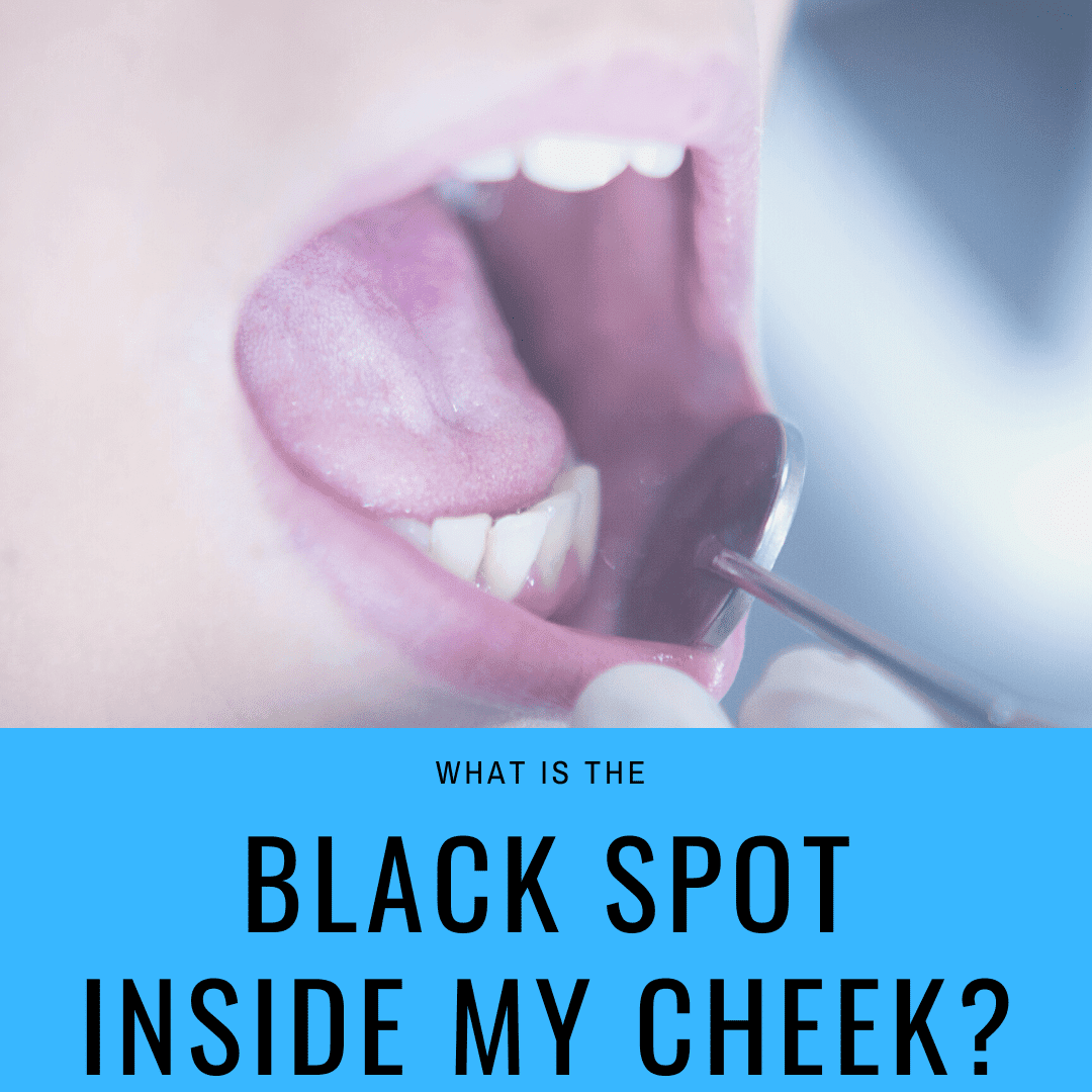 What is the Black Spot Inside my Cheek?