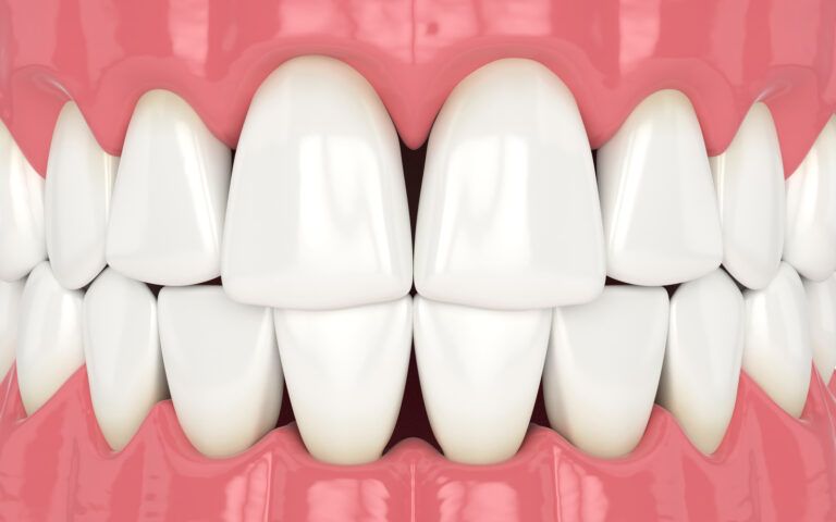 Dental Triangles Vector Image