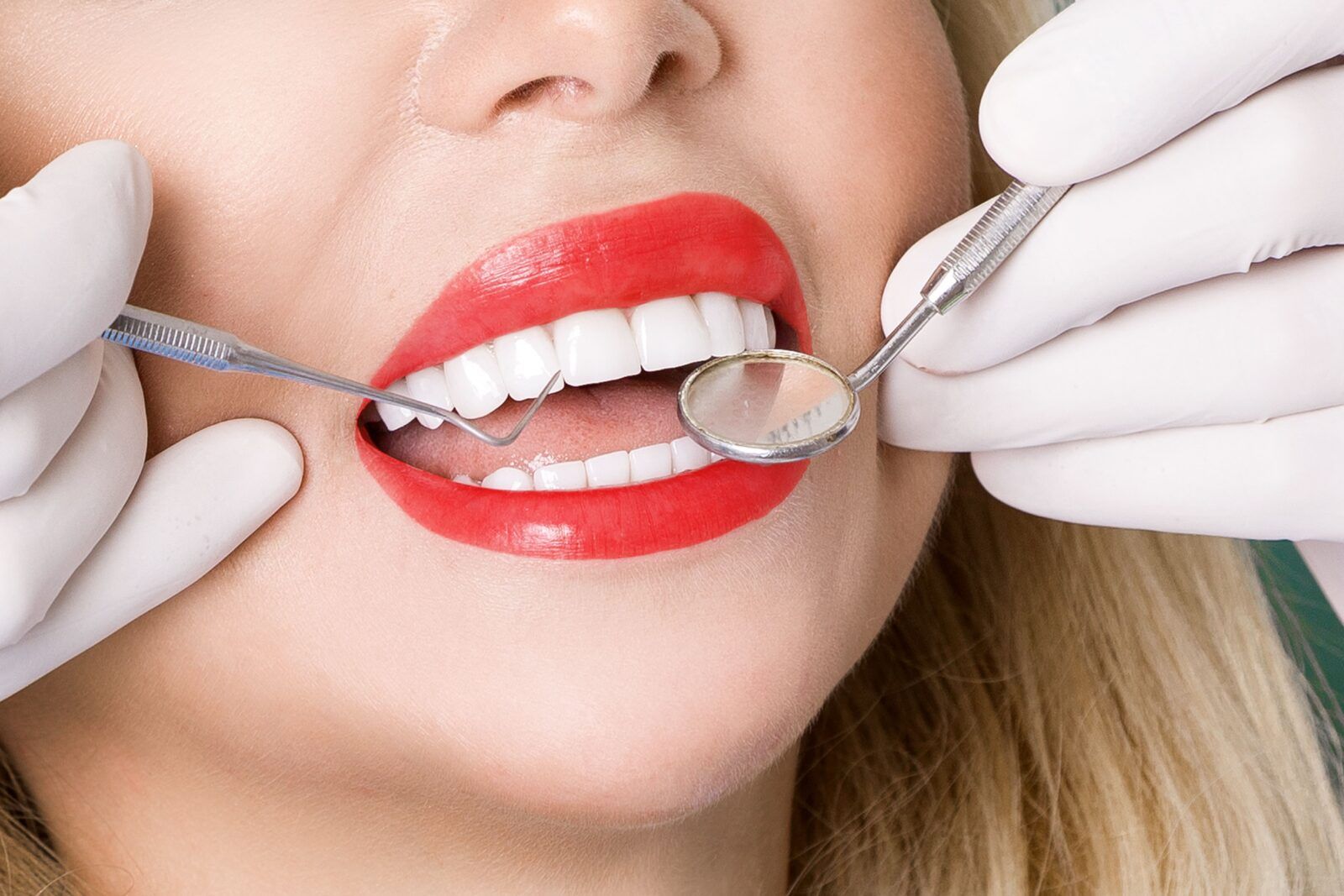 Dental Crowns Vs Dental Veneers Which Cosmetic Dental Treatment Is