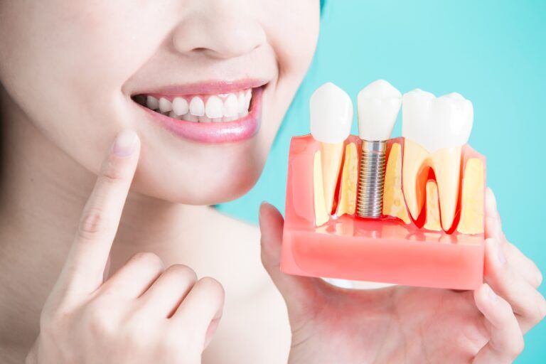 woman pointing to her teeth and smiling while holding dental implant model