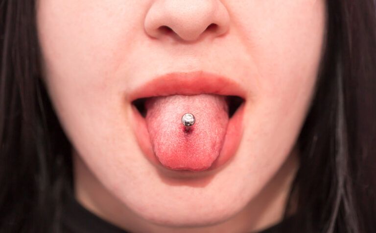 The Risks of Oral Piercings