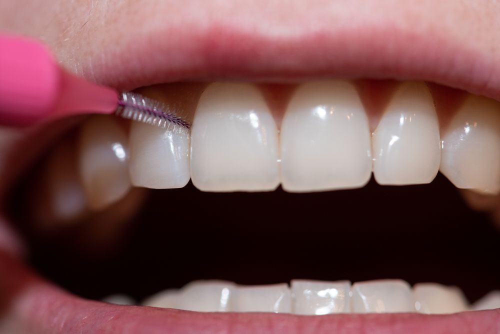 The Importance of Interdental Cleaning