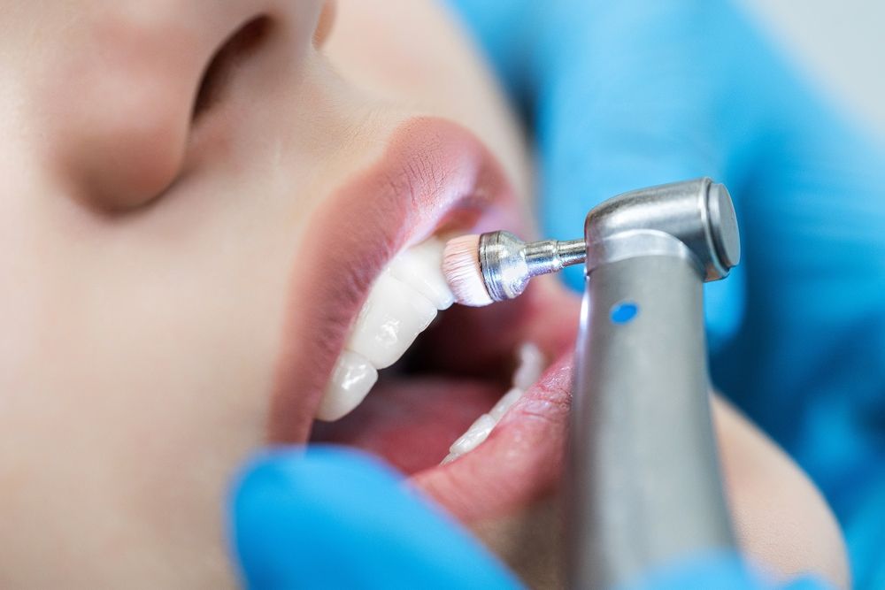 The Dangers of Skipping Dental Cleanings