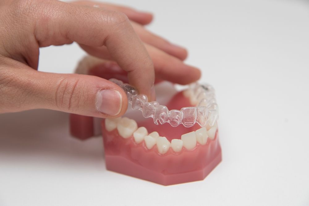 How Invisalign Works: The Clear Alternative to Traditional Braces