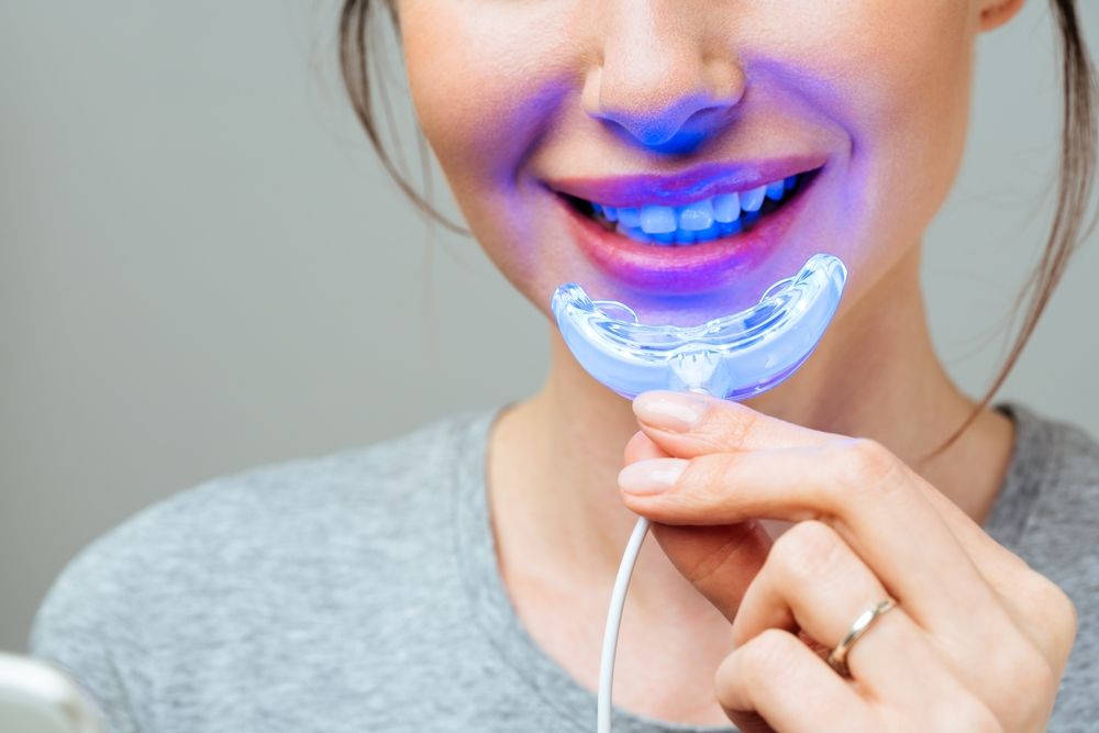 How Safe is At-Home Teeth Whitening? A Complete Guide